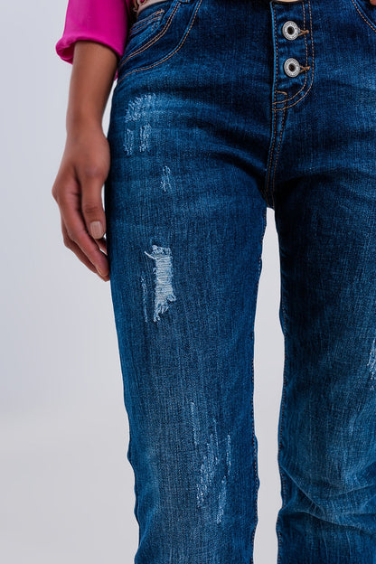 Vaqueros boyfriend azul oscuro rasgados con botones expuestos